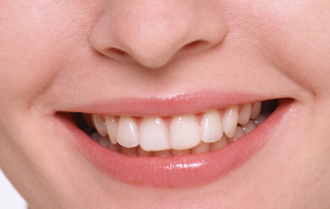 東長崎・とどデンタルクリニック・永久歯の歯並びに影響